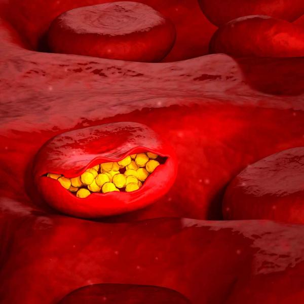 Malaria in blood cells