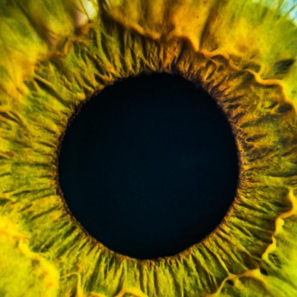 retina of eye