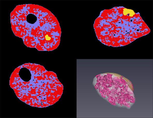 Neutron tomography opalised pearls